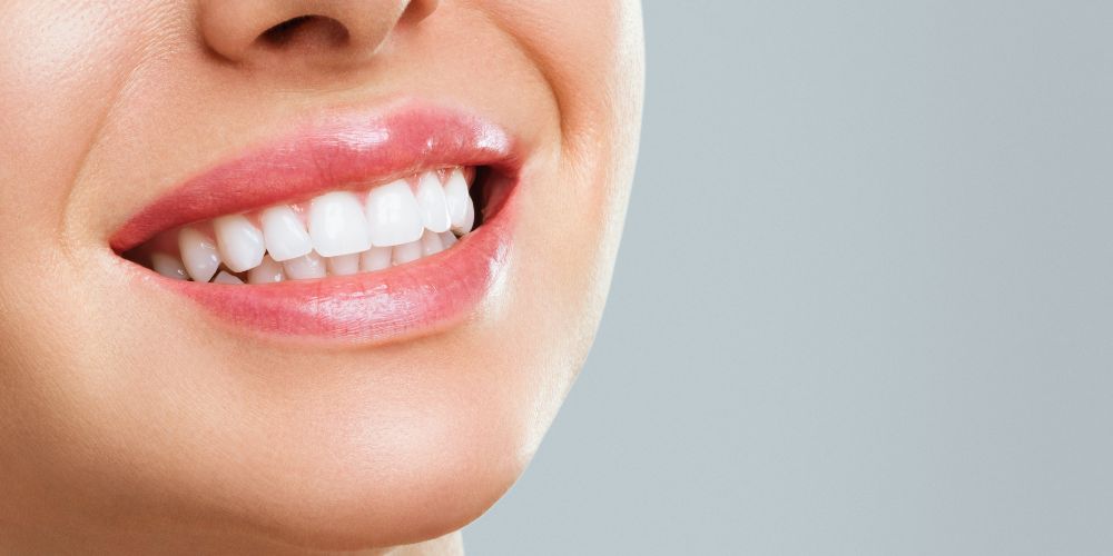 Teeth Whitening at Northview Dental Practice